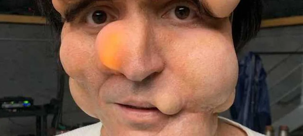 Bolinha